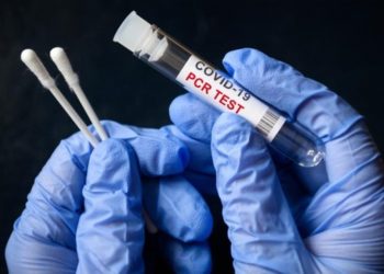 Bepergian Domestik Tidak Lagi Persyaratkan Test Antigen dan PCR