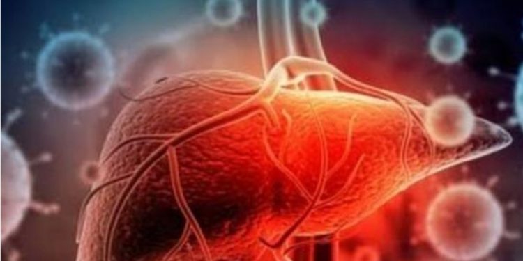 Waspadai Berkembangnya Hepatitis Akut, DPRD Minta Pemprov DKI Bergerak Cepat