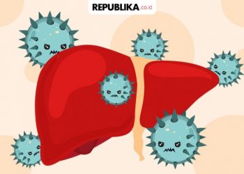Kulit Menguning Hingga Hilang Sadar Tanda Gejala Berat Hepatitis Akut
