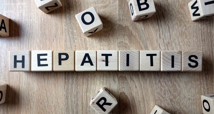 Menkes Sebut Ada 15 Kasus Hepatitis Misterius di RI, Kenali Gejala Awalnya