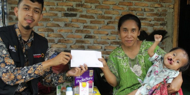 LazisMu Medan Beri Perhatian untuk Aisyah (2) Penderita Bimbir Sumbing dan Gizi Buruk