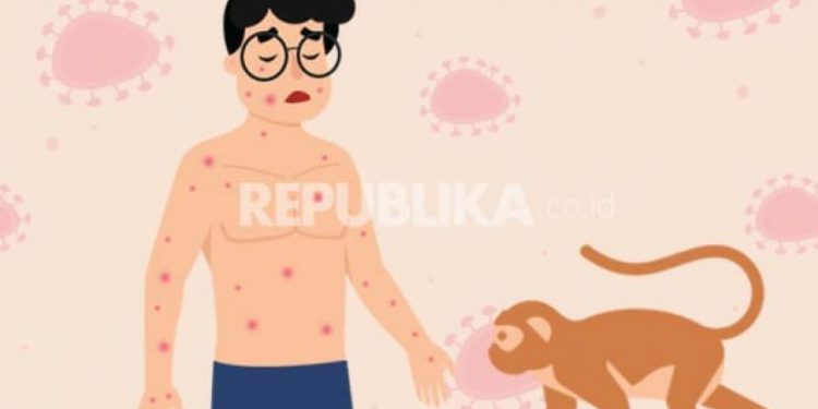 Tujuh Hal tentang Cacar Monyet yang Sudah Ada di Indonesia