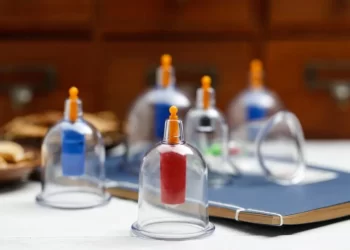 Hukum Bekam dalam Islam, Bolehkah?